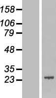 ATRAID / C2orf28 Protein (Over-Expression Lysate Myc-DDK (Flag))