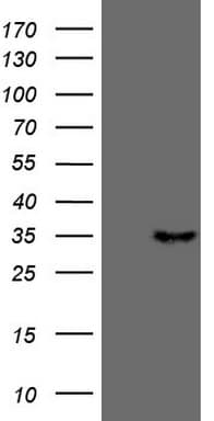 TNFSF5IP1 / CLAST3 Antibody (clone OTI3G10)