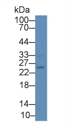 IL17B Antibody (aa21-180)