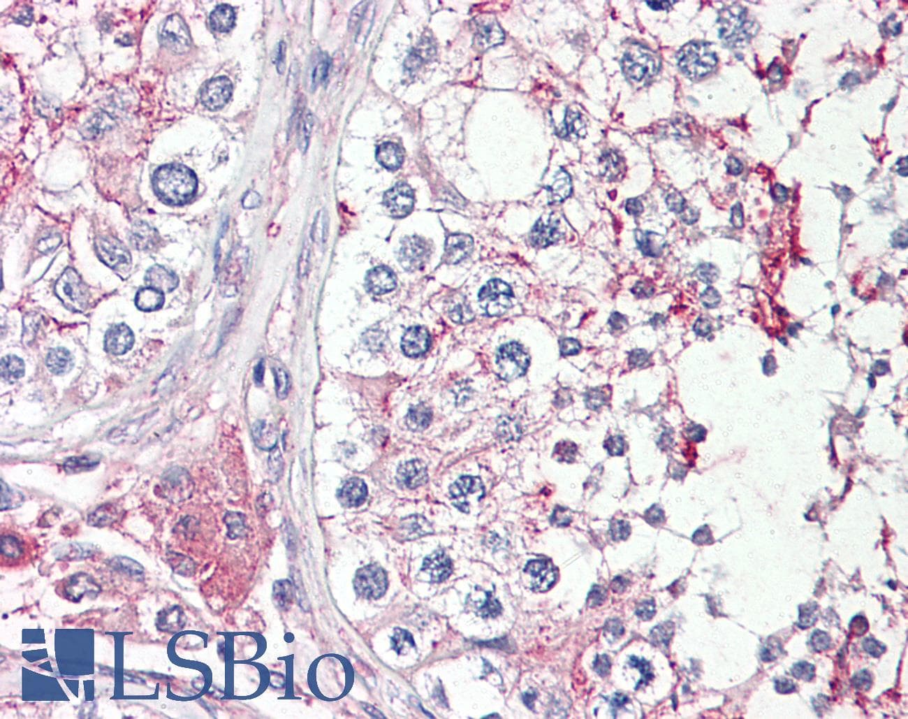 IHC-plus™ Polyclonal Goat anti-Human HRASLS1 / HRASLS Antibody (aa4-17, IHC)