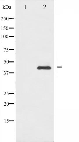 SMAD3 Antibody (phospho-Ser208)