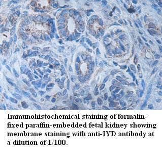 IYD Antibody (aa54-203)