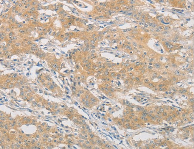 Polyclonal Rabbit anti-Human HIPK4 Antibody (IHC)