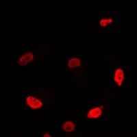 Polyclonal Rabbit anti-Human MYC / c-Myc Antibody (C-Terminus, IHC, IF, WB)