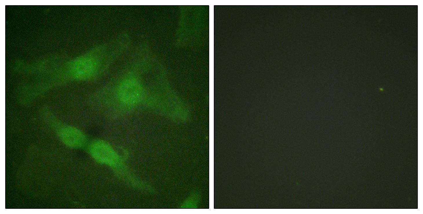 PRKCZ / PKC-Zeta Antibody (phospho-Thr410)