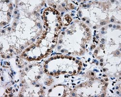 ATP5B / ATP Synthase Beta Antibody (clone OTI6C4)