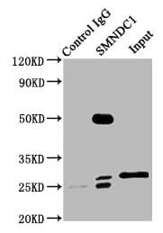 Polyclonal Rabbit anti-Human SMNDC1 Antibody