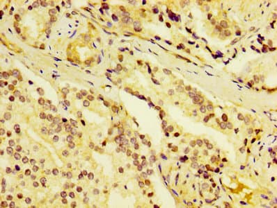 DCD / Dermcidin Antibody