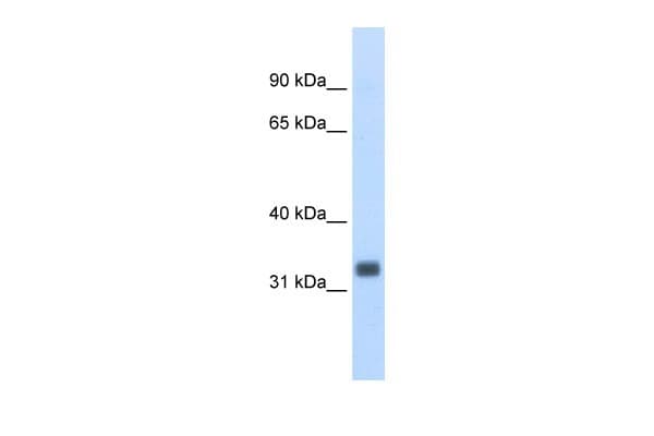 ESE3 / EHF Antibody (aa71-120)