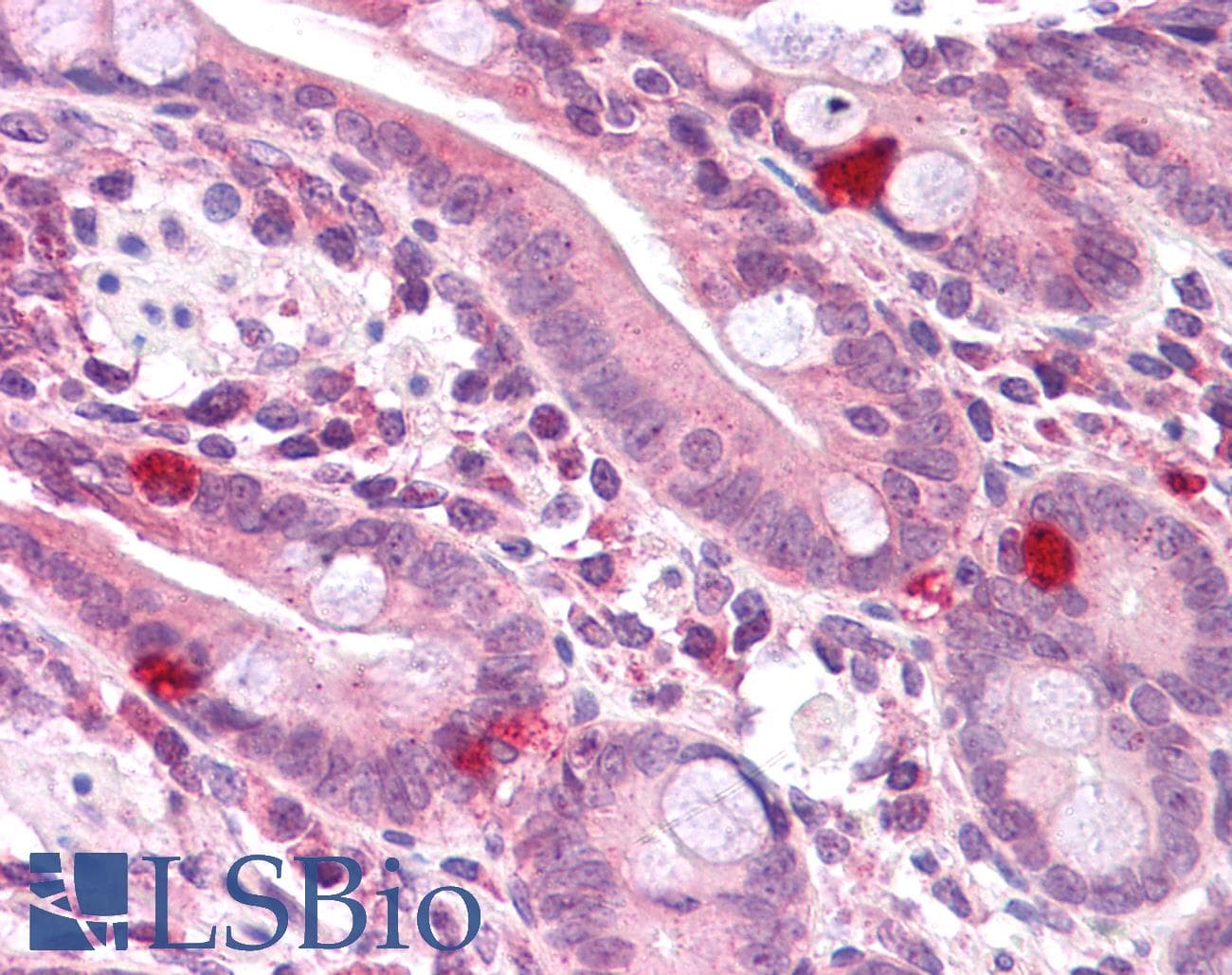 IHC-plus™ Polyclonal Rabbit anti-Human PPAPDC2 Antibody (IHC, IF, WB)
