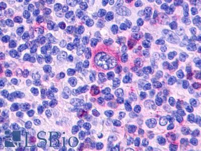 PathPlus™ GPR68 / OGR1 Antibody (Extracellular Domain)