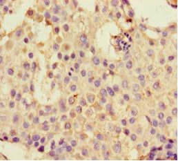 Polyclonal Rabbit anti-Human DDX33 / DHX33 Antibody (IHC, IF, WB)