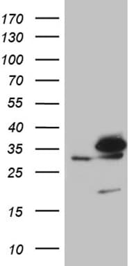 Monoclonal Mouse anti-Human PITPNB Antibody (clone OTI5B10, IHC, WB)