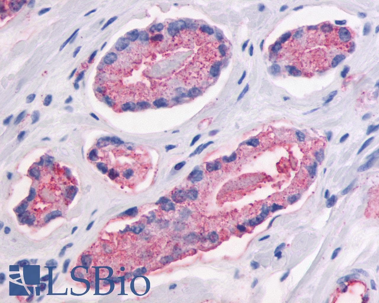 PathPlus™ Polyclonal Rabbit anti-Human GPR87 Antibody (C-Terminus, IHC)