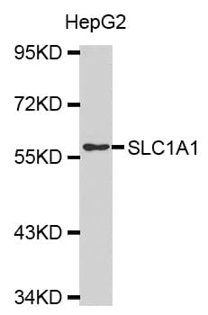 IHC-plus™ Polyclonal Rabbit anti-Human SLC1A1 / EAAT3 Antibody (IHC, IF, WB)