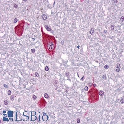 IHC-plus™ Polyclonal Rabbit anti-Human PTHR2 / PTH2R Antibody (C-Terminus, IHC)