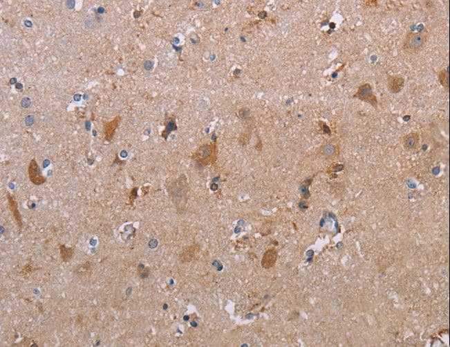 MAGEF1 Antibody