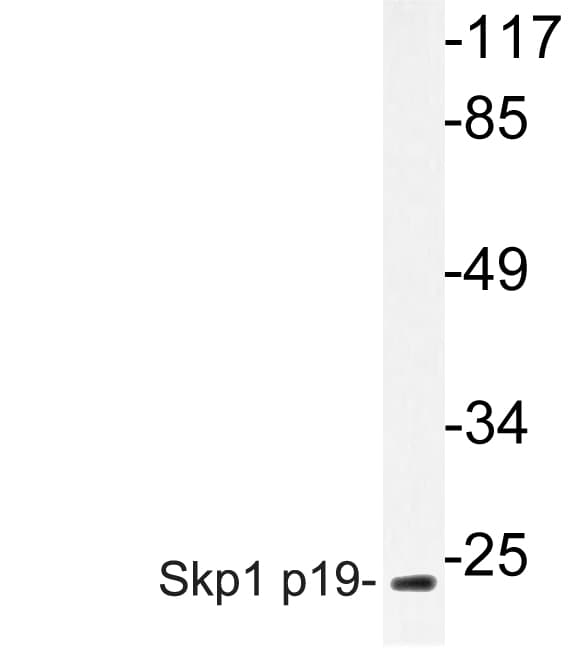 SKP1 Antibody (Pro72)