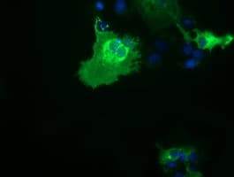 Monoclonal Mouse anti-Human CD80 Antibody (clone OTI2E5, IHC, IF, WB)