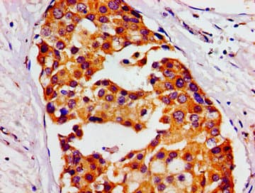Polyclonal Rabbit anti-Human HMMR / CD168 / RHAMM Antibody (IHC, IF)