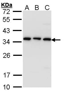 Polyclonal Rabbit anti-Human TBCB / CKAP1 Antibody (aa1-243, IHC, WB)