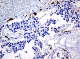 HOXD10 Antibody (aa80-340, clone OTI1D11)