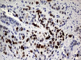 Monoclonal Mouse anti-Human MKI67 / Ki67 Antibody (clone OTI5D7, IHC)