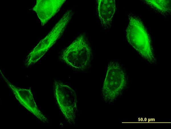TUBA1A / Tubulin Alpha 1a Antibody (clone 2D2)