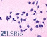 IHC-plus™ C5AR1 / CD88 / C5a Receptor Antibody (N-Terminus)