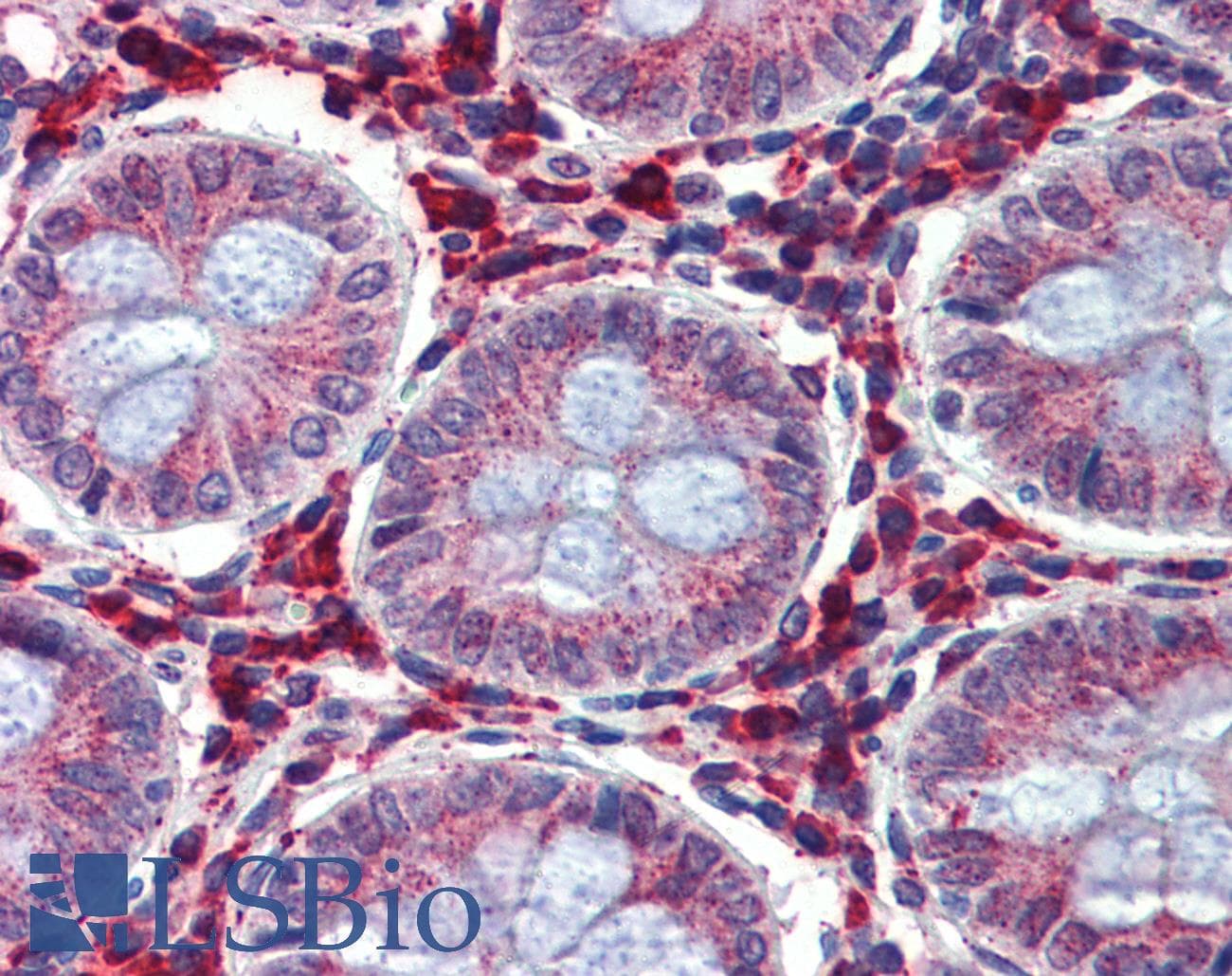 IGFBP4 Antibody (aa180-229)
