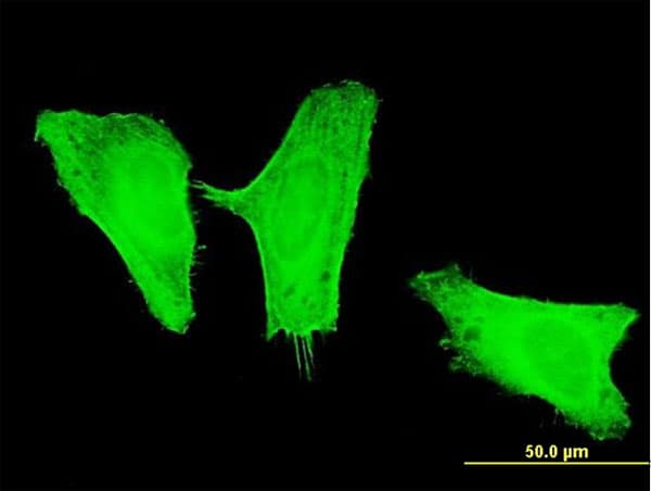PIK3CG / PI3K Gamma Antibody (clone 2G3)