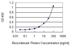 Monoclonal Mouse anti-Human TF / Transferrin Antibody (clone 1C2, IF, WB)