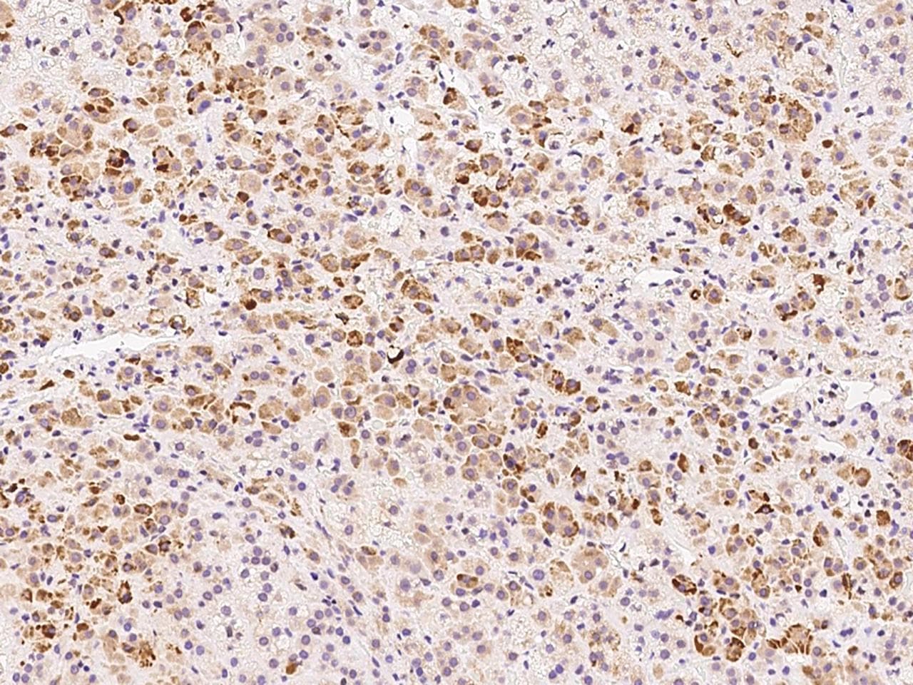 ADAT3 Antibody