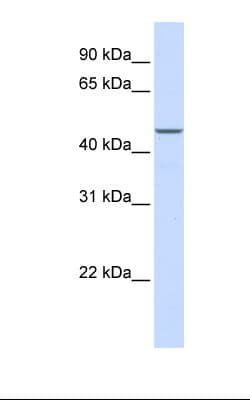 Polyclonal Rabbit anti-Human MAP2K2 / MKK2 / MEK2 Antibody (N-Terminus, IHC, WB)