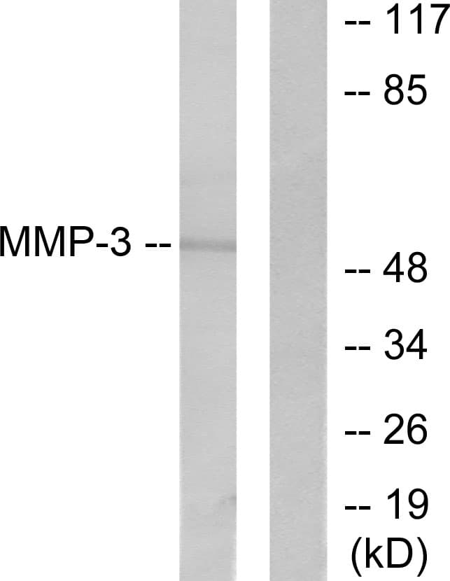 MMP3 Antibody (aa421-470)