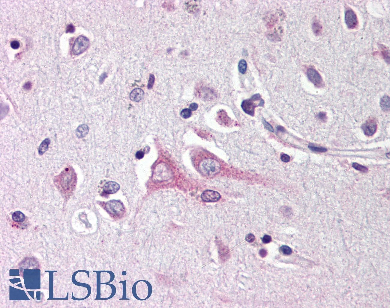 PathPlus™ Polyclonal Rabbit anti-Human NRN1 / Neuritin Antibody (IHC, IF, WB)