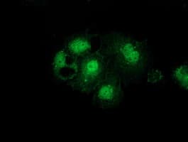 GSS / Glutathione Synthetase Antibody (clone OTI2F2)