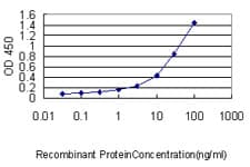 IHC-plus™ CA3 / Carbonic Anhydrase III Antibody (clone 4A12-1A3)