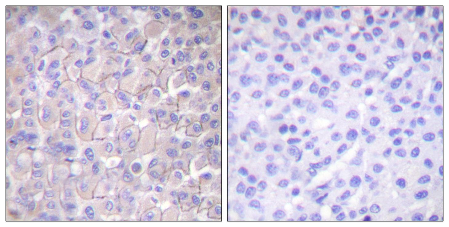EGFR Antibody (phospho-Thr693)
