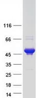 Human ANKRD40 Protein (Recombinant Myc-DDK (Flag))