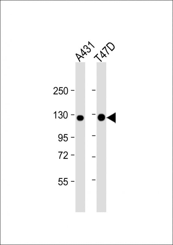 Monoclonal Mouse anti-Human CDH1 / E Cadherin Antibody (clone 1579CT577.150.80, aa1-392, WB)