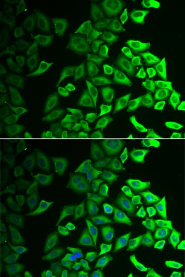 Polyclonal Rabbit anti-Human IL18BP Antibody (IHC, IF, WB)