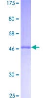 Human RPL10L Protein (Recombinant GST)