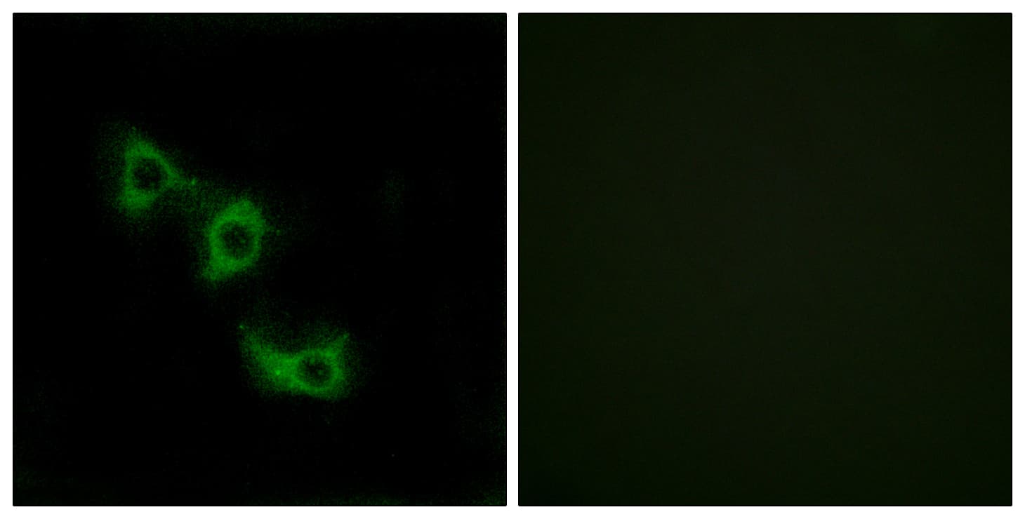 Polyclonal Rabbit anti-Human MRPL44 Antibody (aa221-270, IHC, IF, WB)