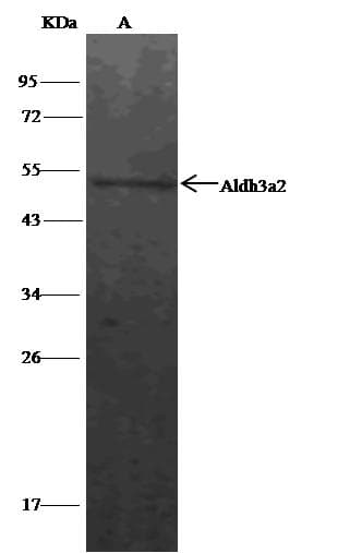 ALDH3A2 Antibody (Preservative Free)