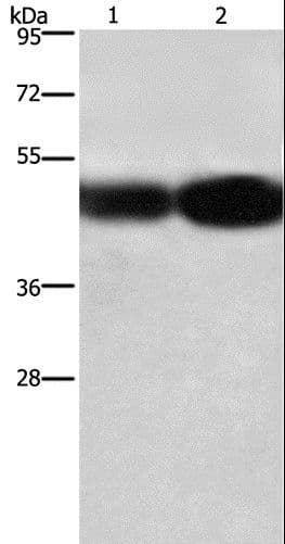 Basigin / Emmprin / CD147 Antibody