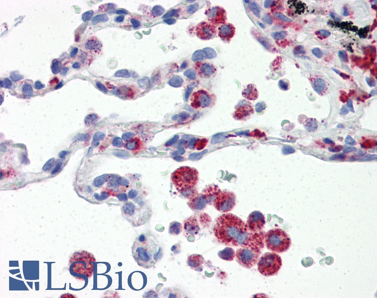 IHC-plus™ IRF7 Antibody (aa1-150, clone 3D9)