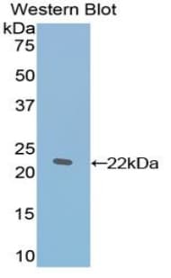 TAF12 Antibody (aa1-161, Biotin)