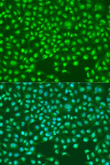 SKP2 Antibody