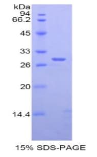 Rat ADAM6 Protein (Recombinant His)